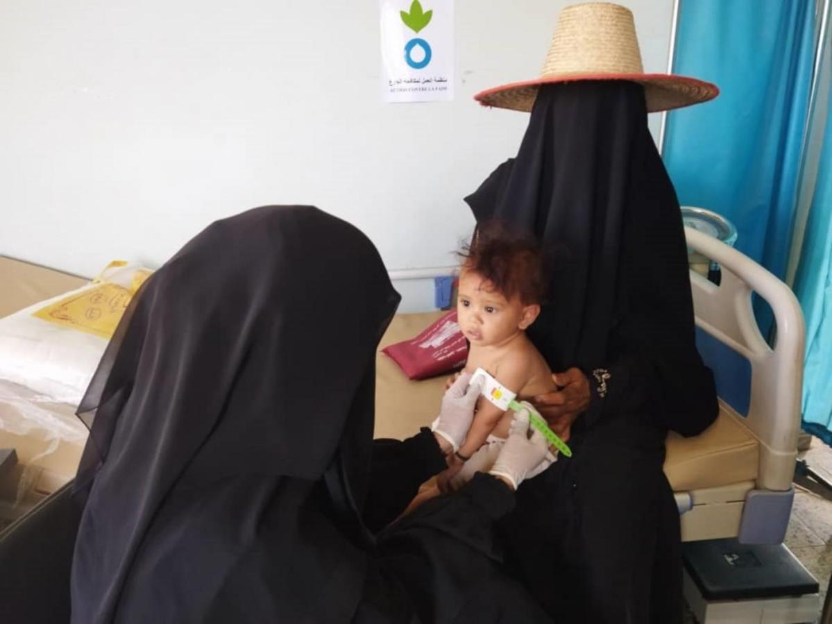 Ahood, una niña yemení, sufre complicaciones por malnutrición